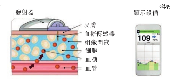 血糖监测仪大变局：国产品牌的全力一击
