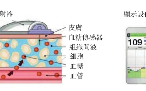 血糖监测仪大变局：国产品牌的全力一击