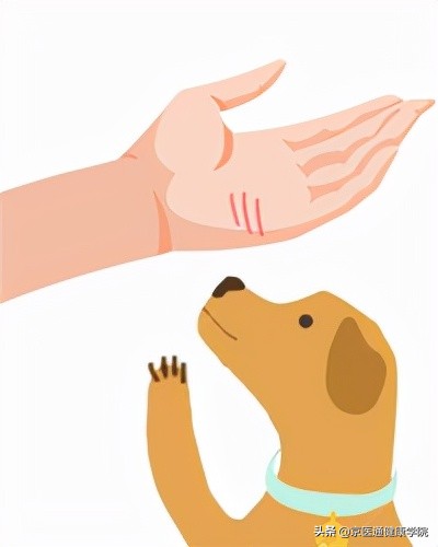 被猫狗抓伤咬伤怎么办？第一步并不是打疫苗