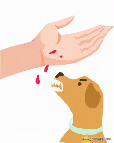 被猫狗抓伤咬伤怎么办？第一步并不是打疫苗
