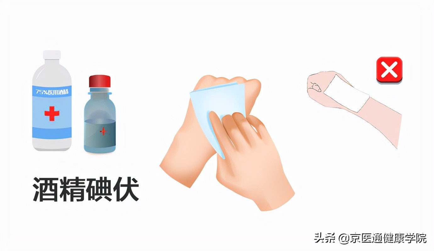 被猫狗抓伤咬伤怎么办？第一步并不是打疫苗